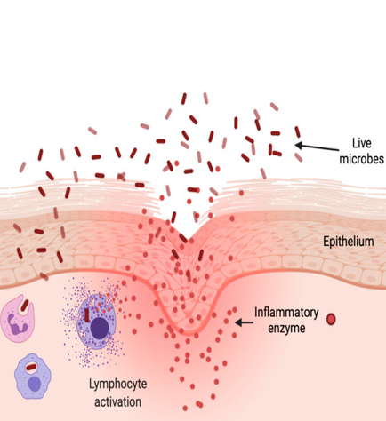 Inflammation